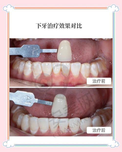 宁波余姚冠杨口腔怎么样？靠谱吗？