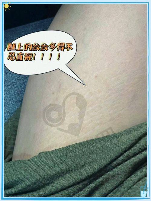 成都军建医院的治疗环境怎么样？