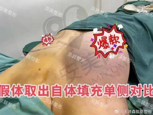 南京米兰柏羽的医生团队怎么样？
