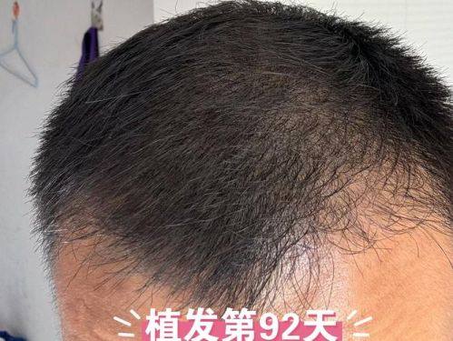 术后修复情况如何？