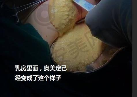 总结