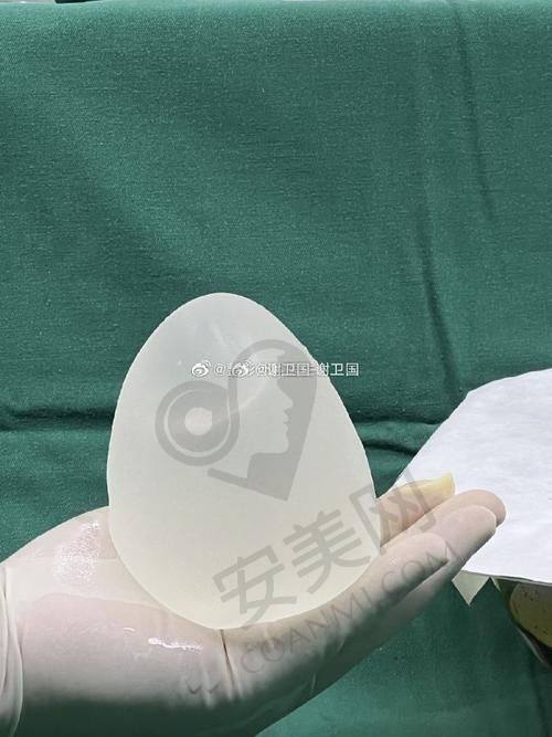 东莞爱思特假体隆胸手术过程是怎样的？