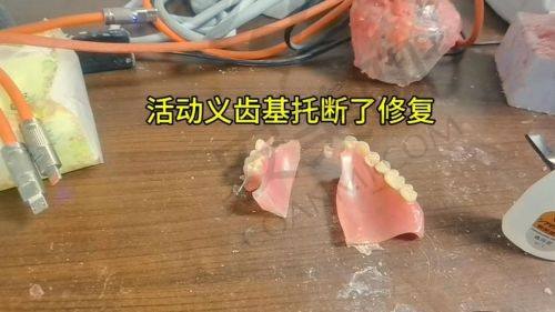 全口假牙的费用是否合理？