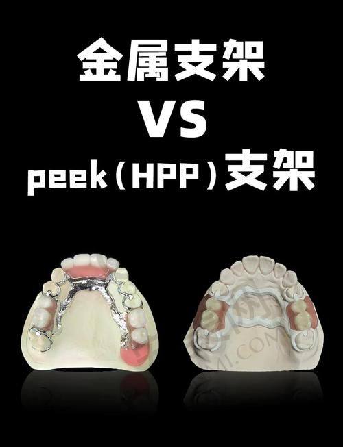 深圳福民鼎植口腔的全口假牙技术有什么特色？