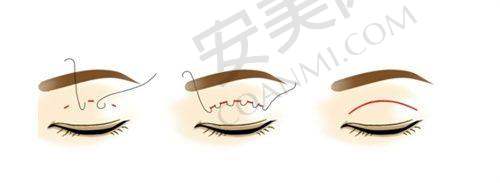 6、宝鸡晶肤刘叶林医生预约挂号指南
