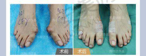 乌鲁木齐华美整形美容医院的价格合理吗？