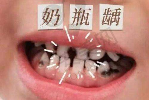 达州绮云口腔种植牙的服务质量如何？
