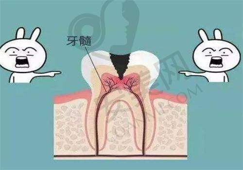第二次治疗：根管预备