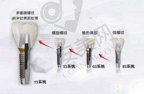 价格体系：透明但需防陷阱