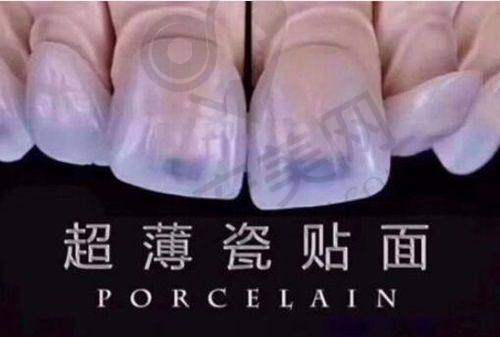 昆明松鼠口腔医院的环境和服务怎么样？