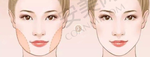 二、深圳素仁医疗美容门诊部正规吗？