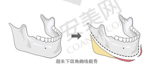 6、西宁韩美陈耿医生预约挂号指南