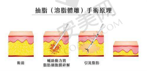 7. 浙江台州温岭芘丽芙整形美容医院