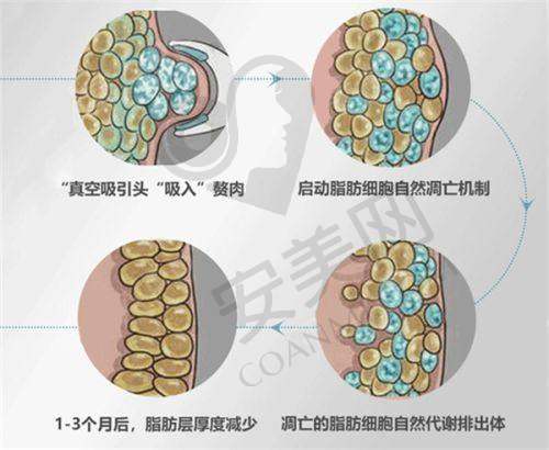 郑州东方整形鼻部整形价格如何？