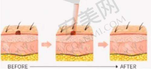 苏州维多利亚端木雪峰医生擅长项目
