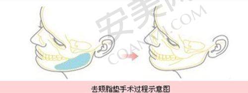 六、苏州维多利亚美容医院患者评价：