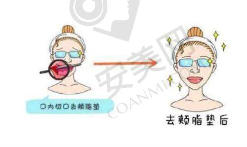 二、西安晶肤医疗美容医院正规吗？