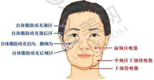 郑州东方整形皮肤美容项目价格贵吗？