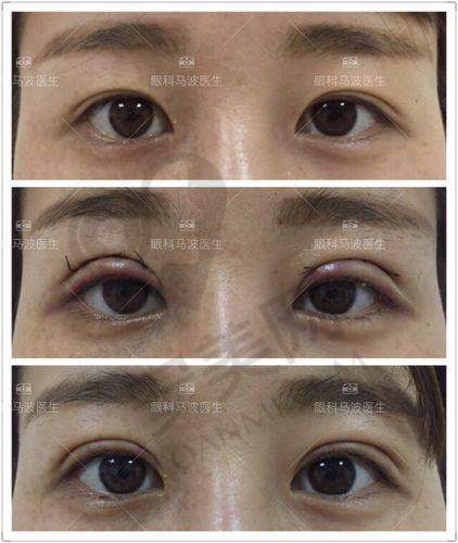 什么是维密Ultra美眼？