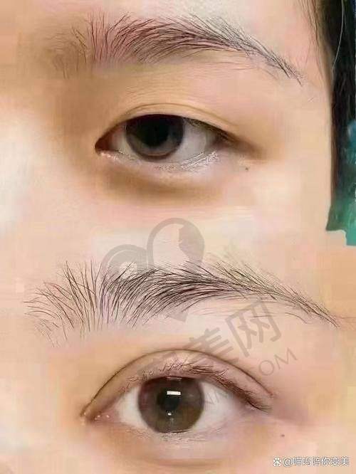 如何预约郑州杨丽美颜的双眼皮修复服务？
