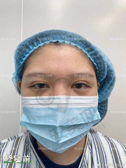 重庆华美眼部整形的优势有哪些？