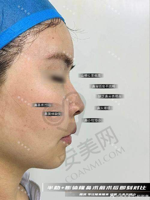 想知道重庆当代王旭明医生鼻及鼻修复咋样？从简介口碑一探究竟