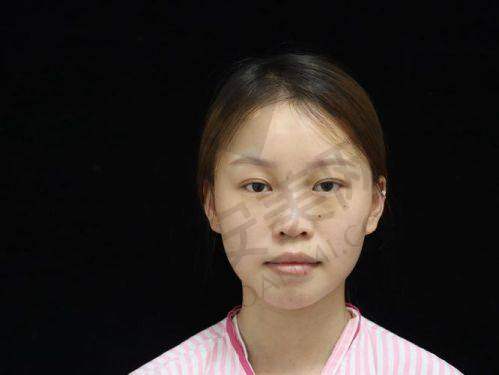 重庆华美医院鼻综合整形的优势有哪些？