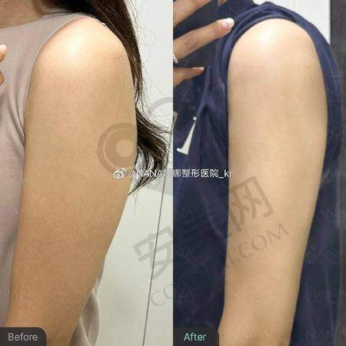 患者对武汉仁爱时光包涛吸脂的评价怎样？
