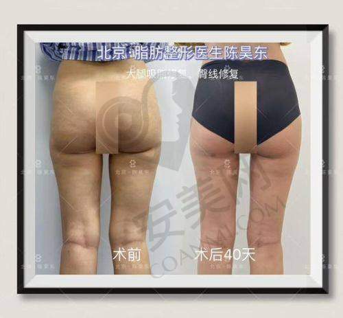 包涛医生在武汉仁爱时光的资历如何？