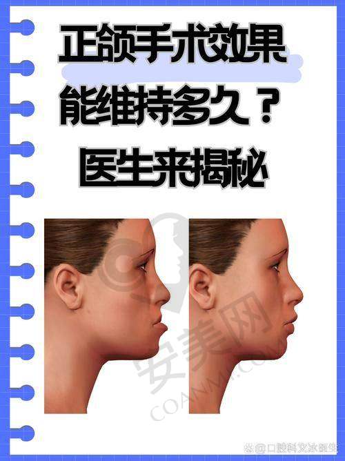 二、北京八大处正颌手术医生名单详解