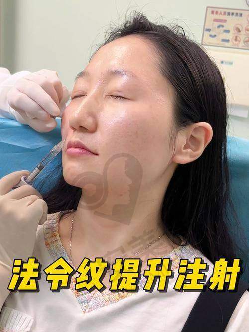 洛阳孔繁荣医院玻尿酸填充法令纹有哪些优势？