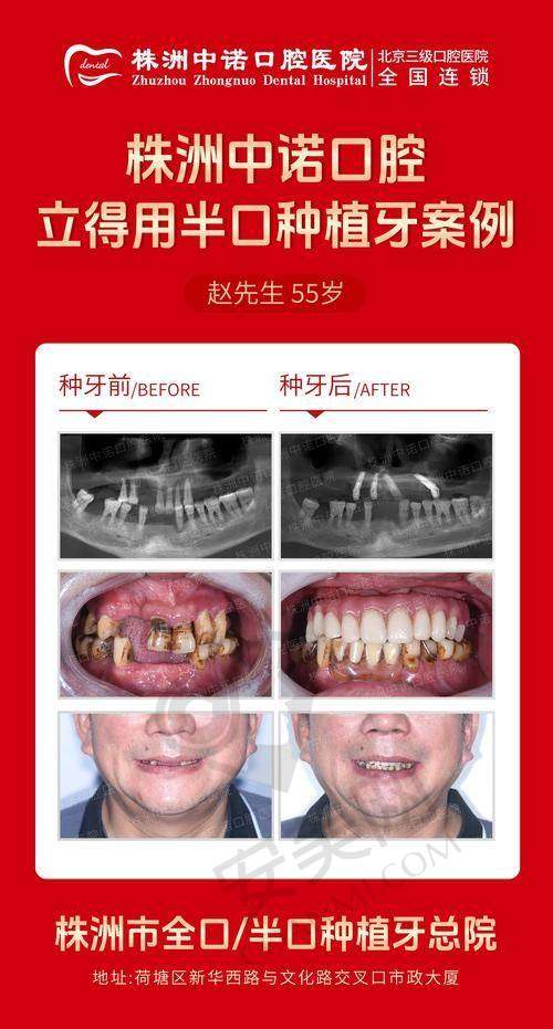 种植方案是如何制定的？
