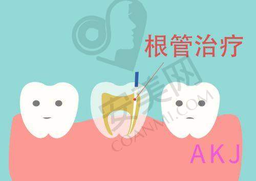 第三次治疗：根管充填