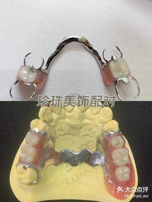 与其他修复方式相比，半口活动义齿有什么特点？