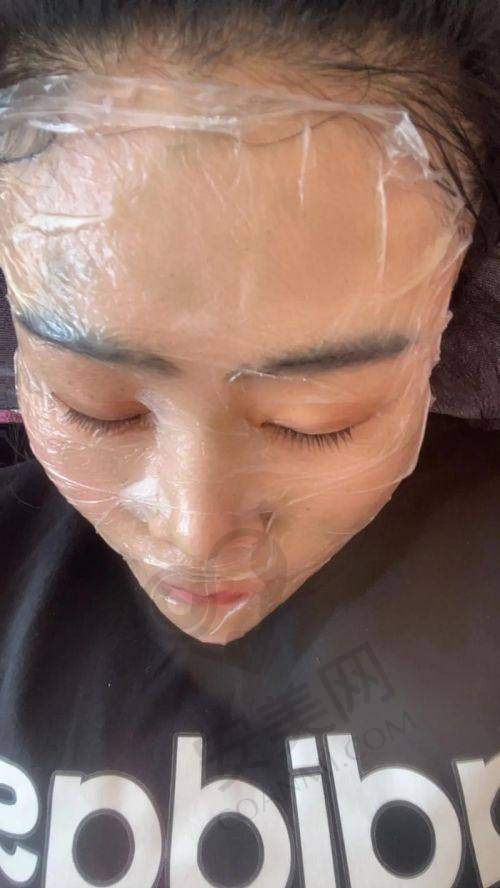 重庆华美皮肤美白抗衰治疗过程是怎样的？