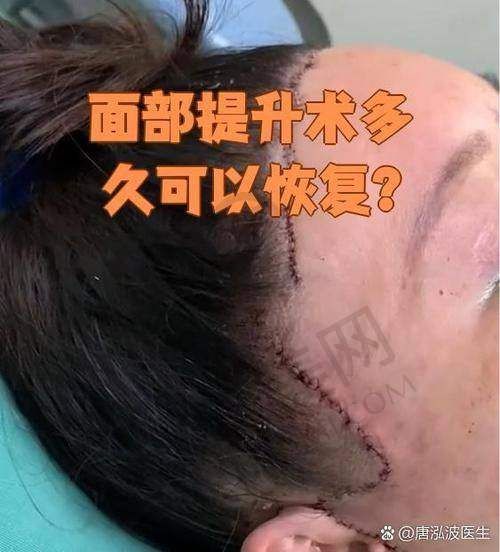 总结