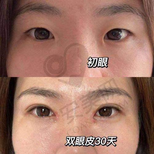 术后修复情况如何，成效是否满意？