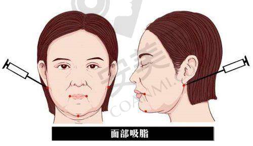杨长征医生的服务态度怎么样？
