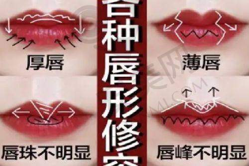 3、汉中名韩熊浩医生整形技术怎么样？