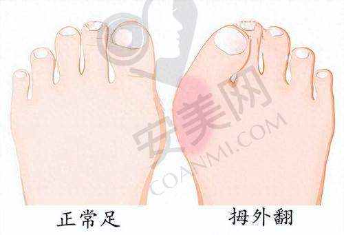 杭州艺星注射玻尿酸的服务怎么样？
