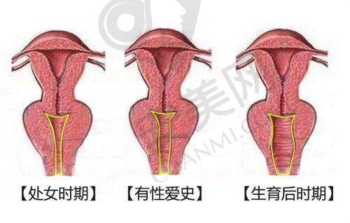 选择祛疤美容医院的注意事项