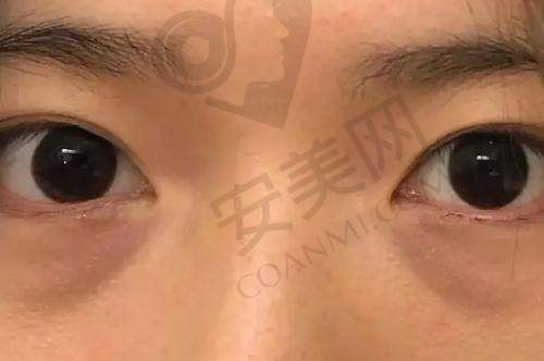 2、徐州心源史德明院长擅长项目：