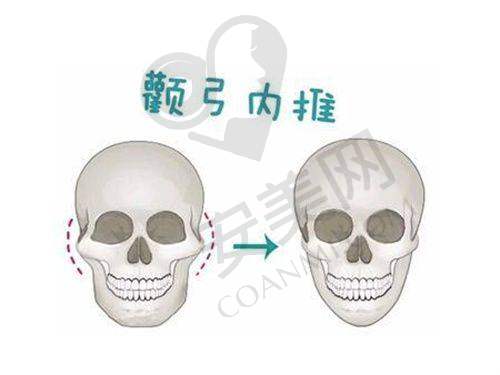 广州祛疤美容医院名单及排名情况
