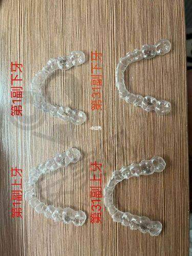 补牙收费标准如何？