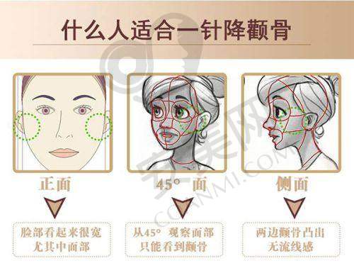 成都华美紫馨医院的价格合理吗？