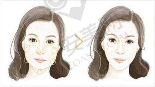 南宁帕拉美医疗美容门诊部预约挂号流程：