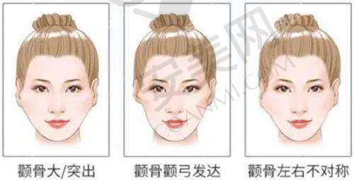 西宁时光王双余医生整形技术怎么样？