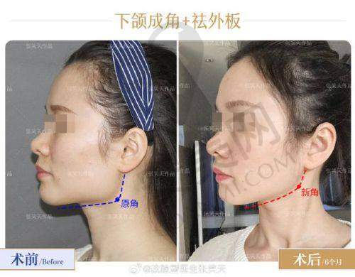 北京张笑天医生的患者评价如何？