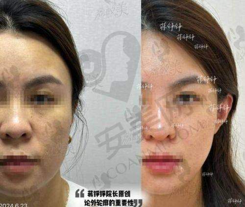 南宁帕拉美医疗美容门诊部预约挂号流程：