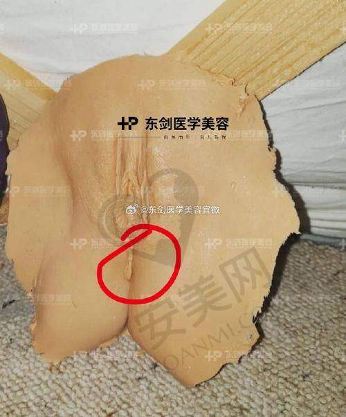 西安画美女性私密整形技术有什么特色？